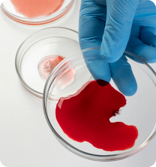 Transplant and Tissue Typing Billing Services